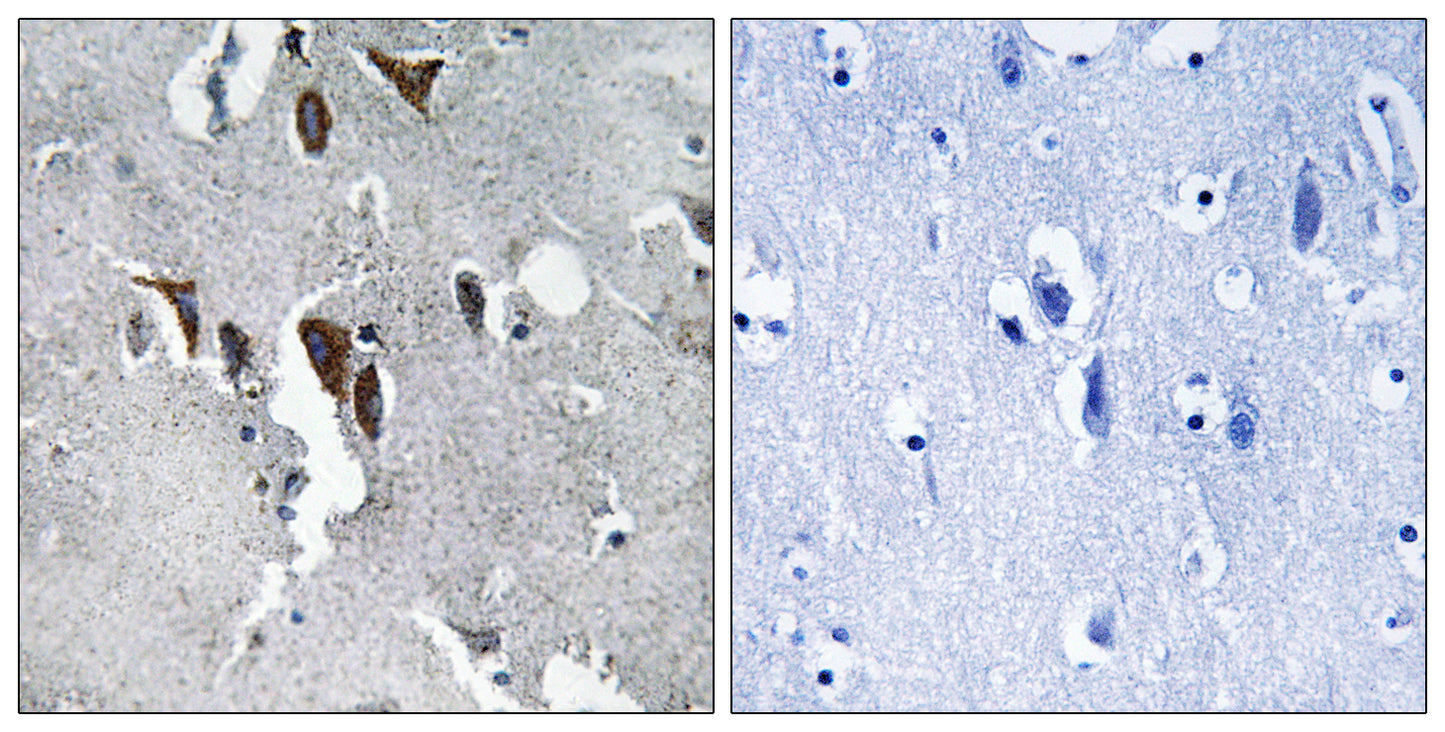 ELOVL5 Rabbit Polyclonal Antibody
