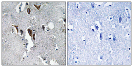 ELOVL5 Rabbit Polyclonal Antibody