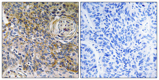 EMMPRIN Rabbit Polyclonal Antibody