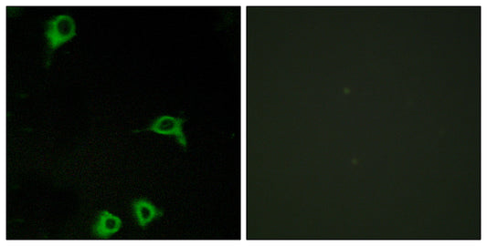 EMR2 Rabbit Polyclonal Antibody