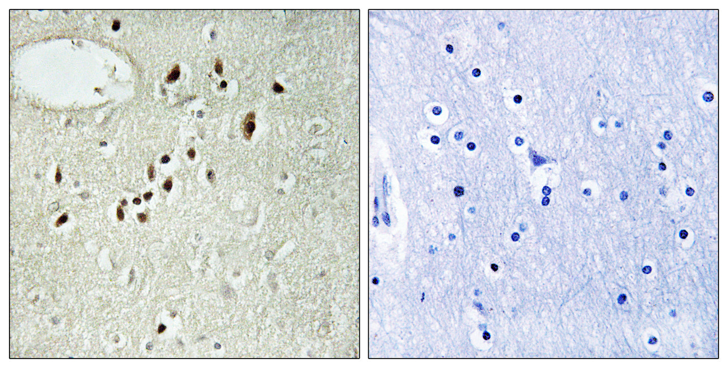 Emx2 Rabbit Polyclonal Antibody
