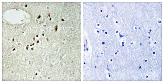 Emx2 Rabbit Polyclonal Antibody