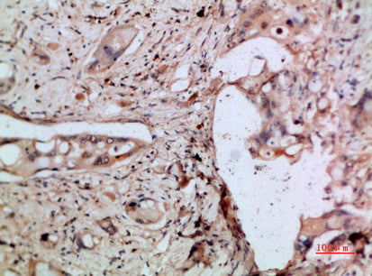 ENA-78 Rabbit Polyclonal Antibody