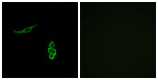 ENaCδ Rabbit Polyclonal Antibody
