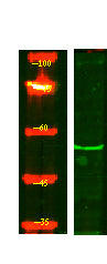 ENDD1 Rabbit Polyclonal Antibody