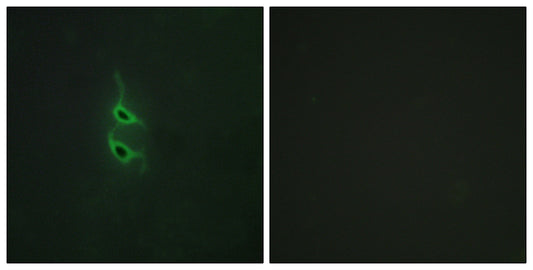 Endo180 Rabbit Polyclonal Antibody