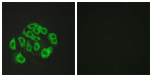 Endomucin Rabbit Polyclonal Antibody