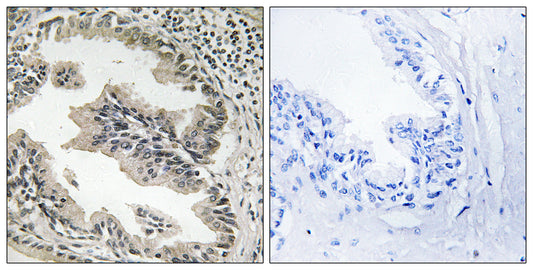 Endophilin B2 Rabbit Polyclonal Antibody