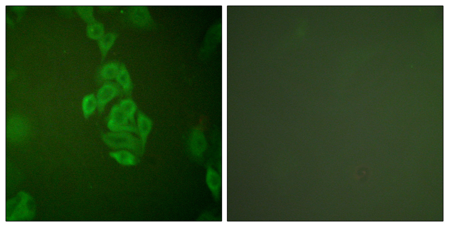 Enolase Rabbit Polyclonal Antibody