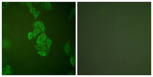 Enolase Rabbit Polyclonal Antibody