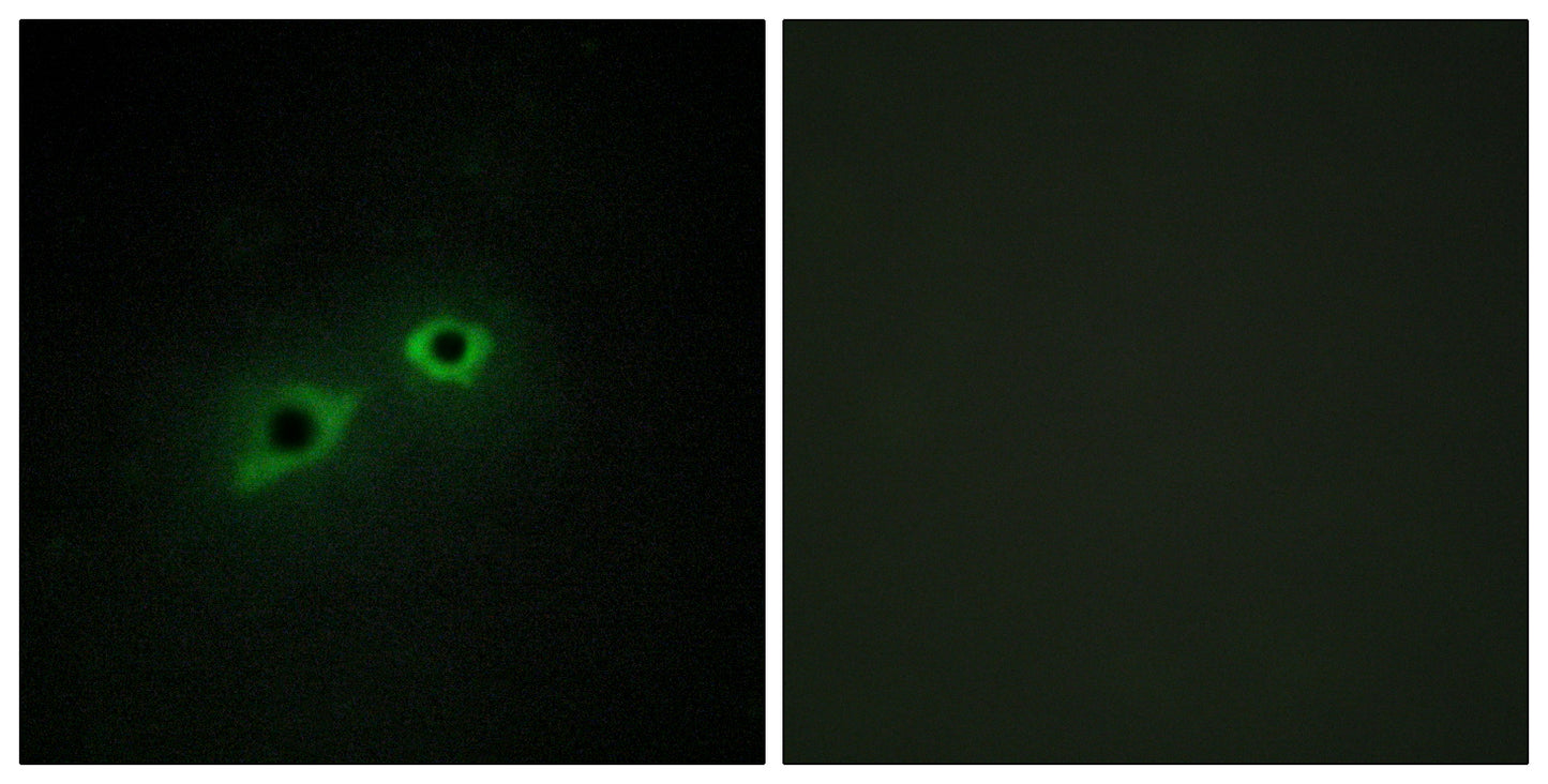 Enterokinase HC Rabbit Polyclonal Antibody