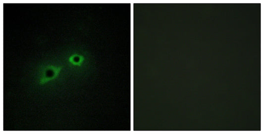 Enterokinase HC Rabbit Polyclonal Antibody