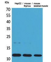 Eotaxin Rabbit Polyclonal Antibody