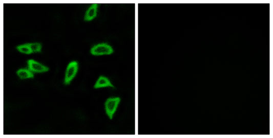 EP3 Rabbit Polyclonal Antibody