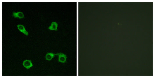 EP3 Rabbit Polyclonal Antibody