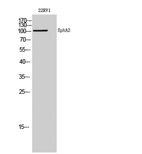 EphA2 Rabbit Polyclonal Antibody