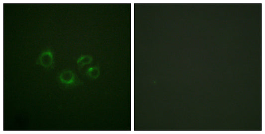 EphA2/3/4 Rabbit Polyclonal Antibody