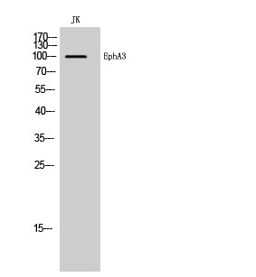 EphA3 Rabbit Polyclonal Antibody