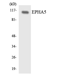 EphA5 Rabbit Polyclonal Antibody