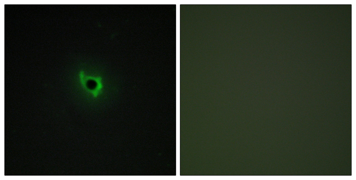 EphA6 Rabbit Polyclonal Antibody