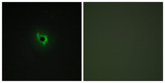 EphA6 Rabbit Polyclonal Antibody