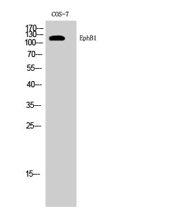 EphB1 Rabbit Polyclonal Antibody