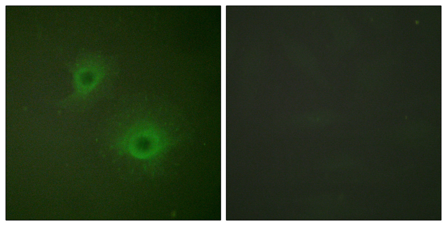 EphB1/2 Rabbit Polyclonal Antibody