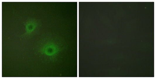 EphB1/2 Rabbit Polyclonal Antibody