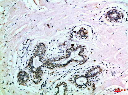 EphB3 Rabbit Polyclonal Antibody