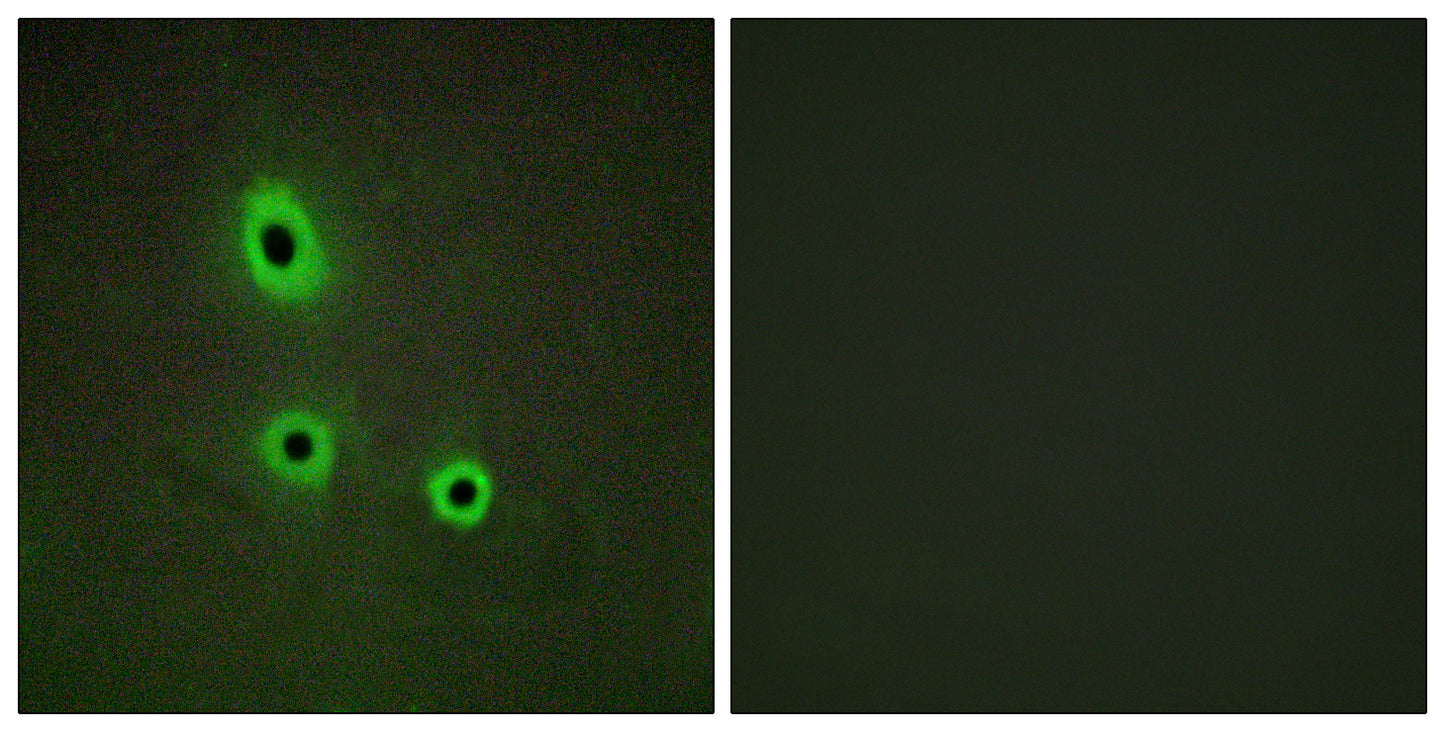 Ephrin-A5 Rabbit Polyclonal Antibody