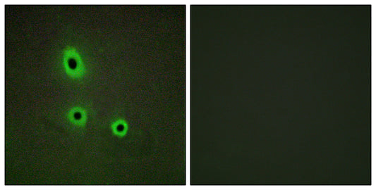 Ephrin-A5 Rabbit Polyclonal Antibody