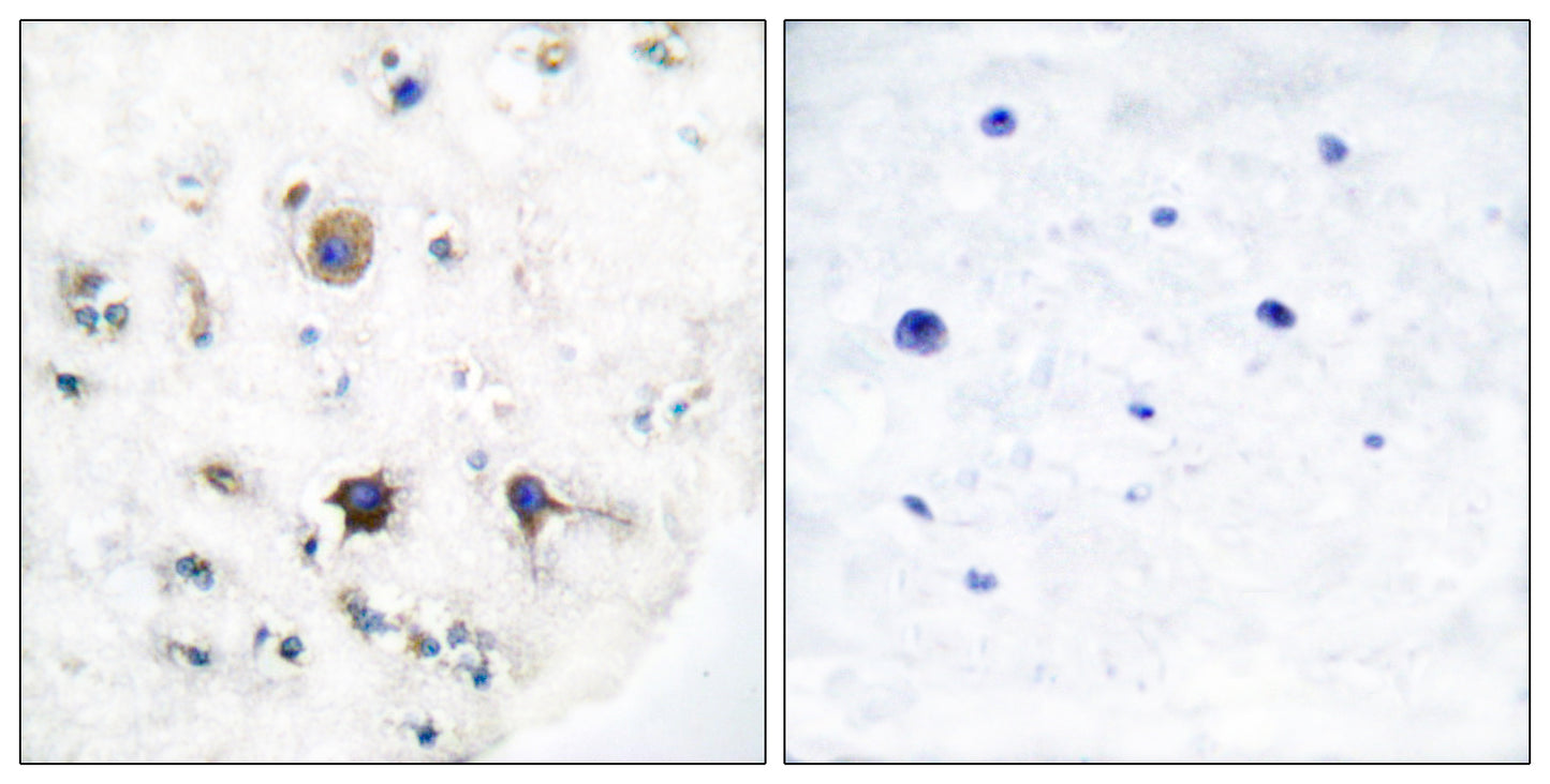 Ephrin-B3 Rabbit Polyclonal Antibody
