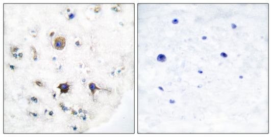 Ephrin-B3 Rabbit Polyclonal Antibody