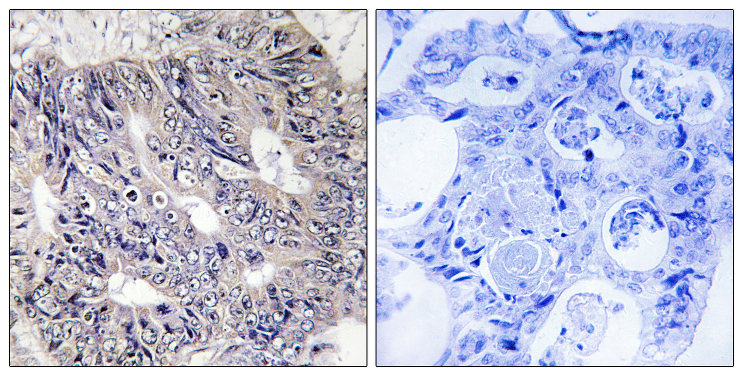 Eps8L1 Rabbit Polyclonal Antibody