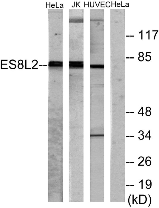 Eps8L2 Rabbit Polyclonal Antibody