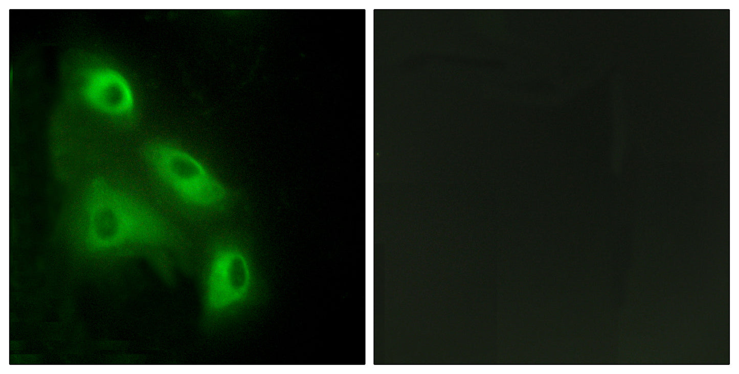 Eps8L3 Rabbit Polyclonal Antibody