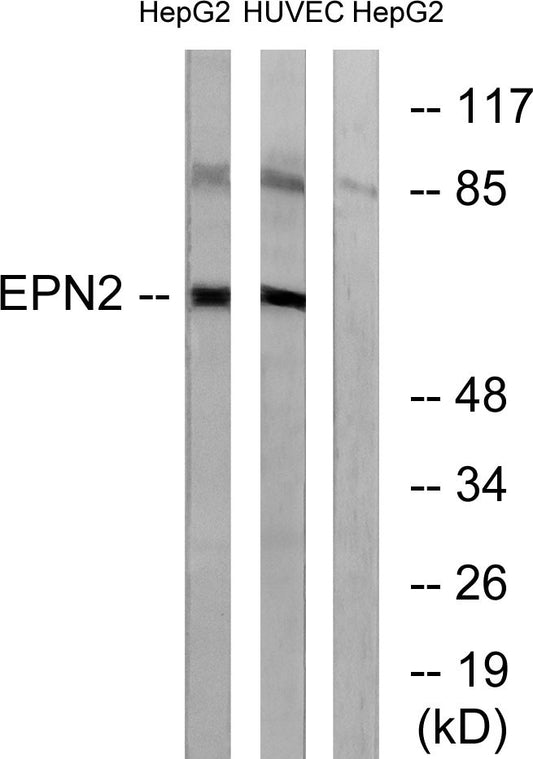 Epsin 2 Rabbit Polyclonal Antibody