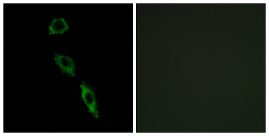 E-Ras Rabbit Polyclonal Antibody