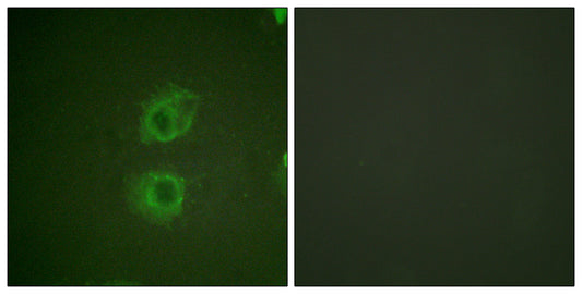 ErbB-3 Rabbit Polyclonal Antibody