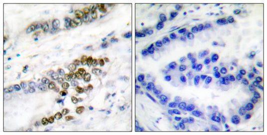 ERCC1 Rabbit Polyclonal Antibody