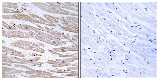 ERdj3 Rabbit Polyclonal Antibody