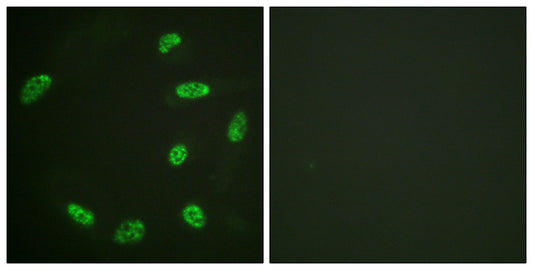 ERF Rabbit Polyclonal Antibody