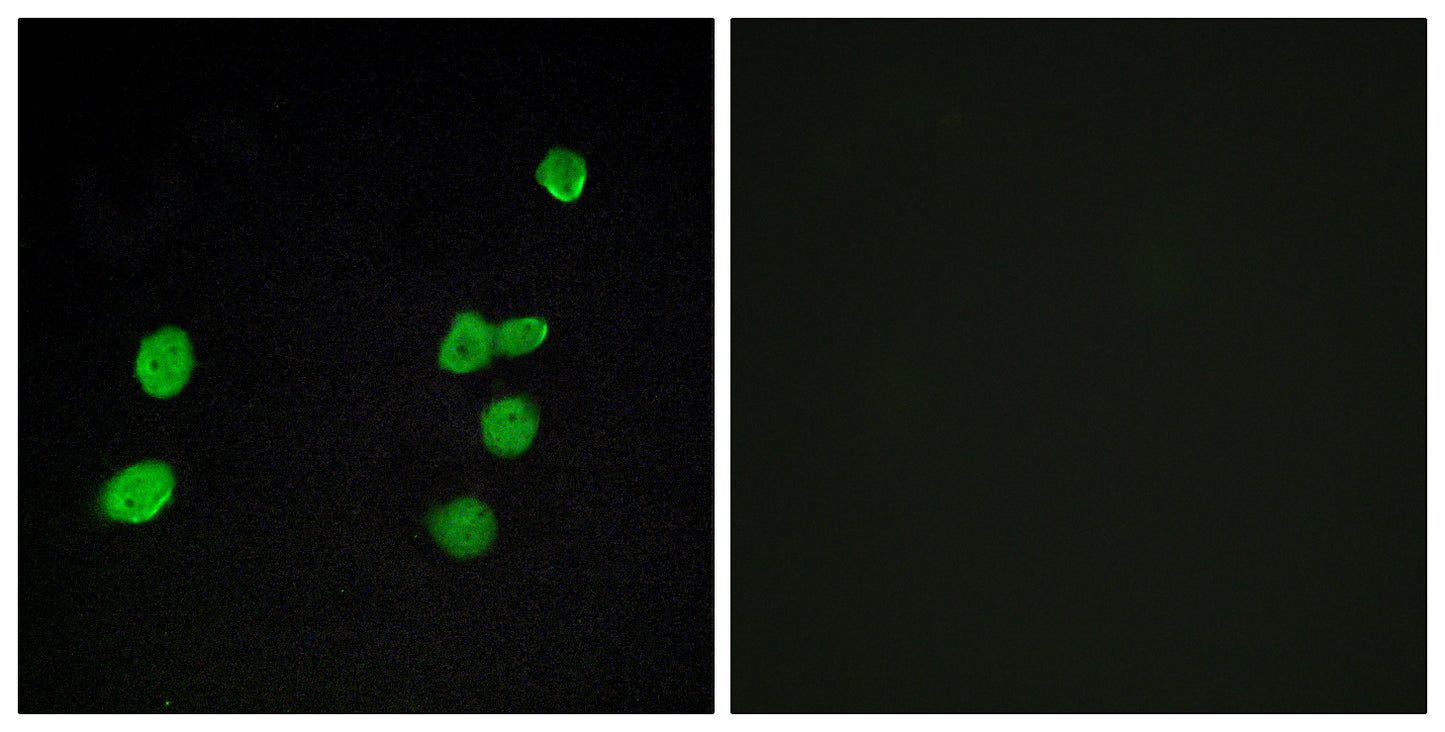 ERK 3 Rabbit Polyclonal Antibody