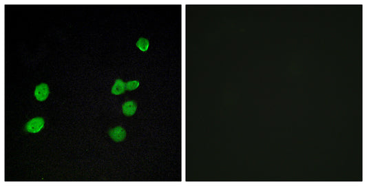 ERK 3 Rabbit Polyclonal Antibody