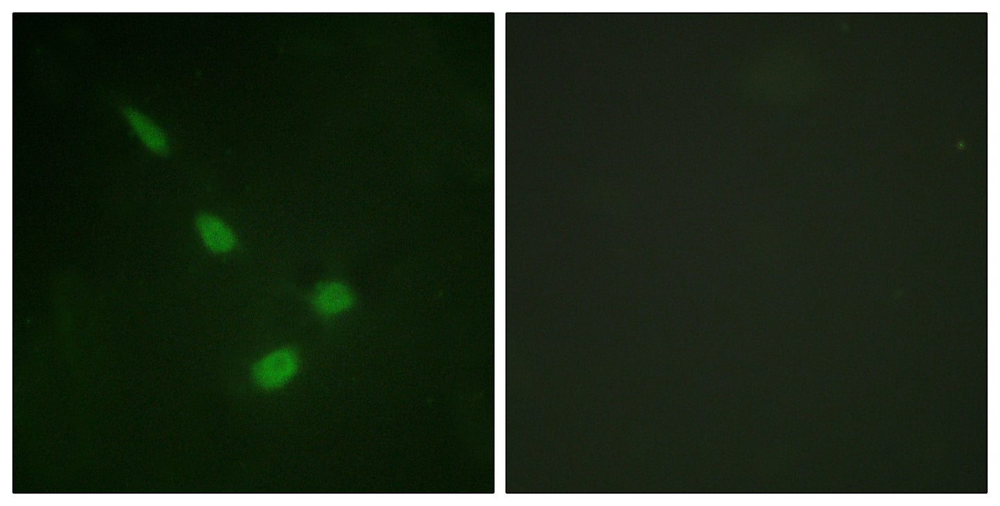 ERK 8 Rabbit Polyclonal Antibody