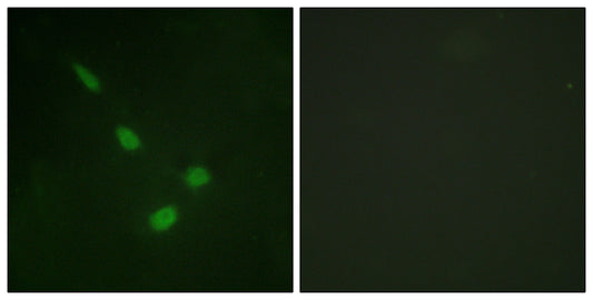 ERK 8 Rabbit Polyclonal Antibody
