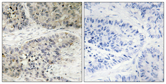 ERK 8 Rabbit Polyclonal Antibody