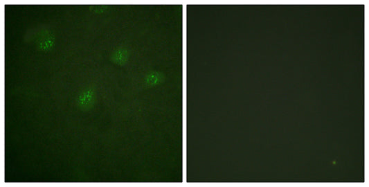 ERα Rabbit Polyclonal Antibody