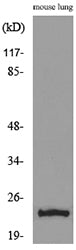 ET-1 Rabbit Polyclonal Antibody