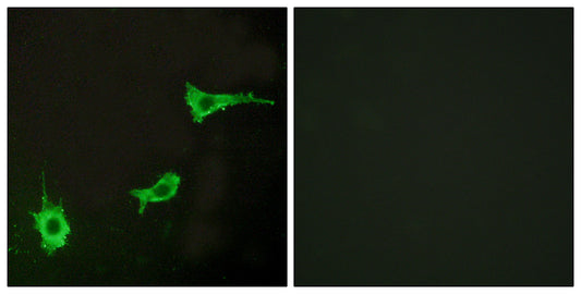ETAR Rabbit Polyclonal Antibody